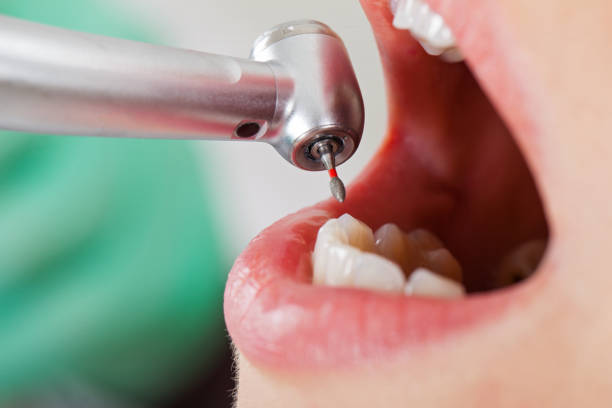 Best Dentist for Tooth Abscess  in Marmora, NJ